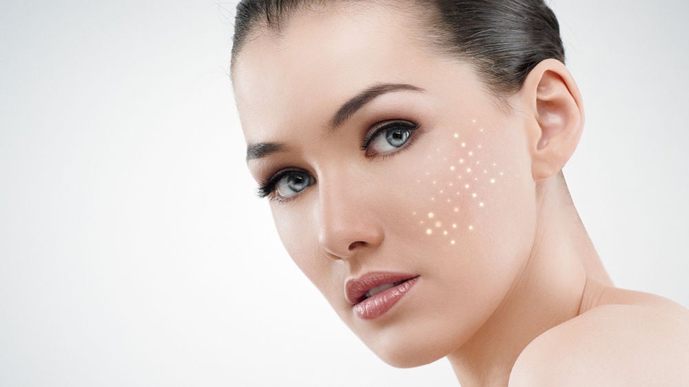 Radiofrequenz Needling SylfirmX Hautverjüngung Fellbach